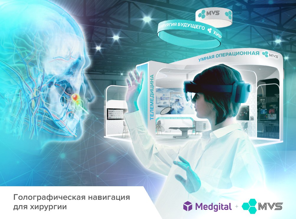 Medgital Holographic surgical Navigation system as part of the MVS Smart Operating Room
